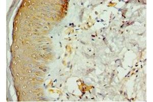 Immunohistochemistry of paraffin-embedded human skin tissue using ABIN7168977 at dilution of 1:100