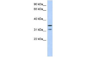 WB Suggested Anti-C17orf81 Antibody Titration: 0. (Retinoic Acid Induced 12 (RAI12) (Middle Region) Antikörper)