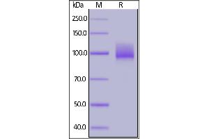 ACE2 Protein (His tag,AVI tag,Biotin)