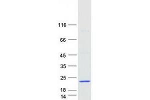 ALOX5AP Protein (Myc-DYKDDDDK Tag)
