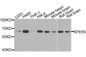Western blot analysis of extracts of various cell lines, using RPE65 antibody. (RPE65 Antikörper)