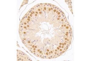 Immunohistochemistry of paraffin embedded rat testis using USP34 (ABIN7076115) at dilution of 1:700 (400x lens)