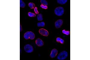 Immunofluorescence (IF) image for anti-Nucleoporin 153kDa (NUP153) (AA 50-100) antibody (ABIN7448391) (NUP153 Antikörper  (AA 50-100))