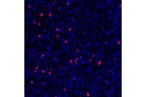 Immunofluorescence (IF) image for anti-Forkhead Box P3 (FOXP3) (AA 275-325) antibody (ABIN7455209) (Rekombinanter FOXP3 Antikörper  (AA 275-325))