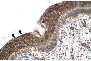 Human Spermatophore; Rabbit Anti-ZFP1 Antibody. (Zfp-1 Antikörper  (N-Term))