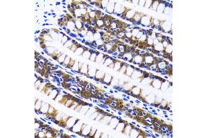 Immunohistochemistry of paraffin-embedded human colon using FASN antibody (ABIN1872662) at dilution of 1:100 (40x lens). (Fatty Acid Synthase Antikörper)