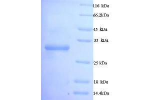 SDS-PAGE (SDS) image for Cytochrome P450, Family 21, Subfamily A, Polypeptide 2 (CYP21A2) (AA 2-261) protein (His tag) (ABIN5713300)