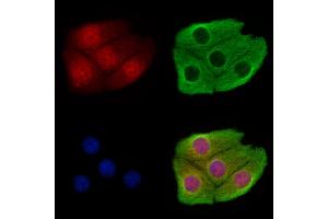 ABIN7094493 and ABIN7098542 staining Hela cells by IF/ICC. (CHD4 Antikörper  (Internal Region))