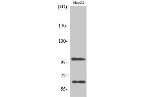 Western Blotting (WB) image for anti-Signal-Regulatory Protein alpha (SIRPA) (C-Term) antibody (ABIN3186961)