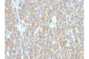 Image no. 1 for anti-B-Cell CLL/lymphoma 6 (BCL6) antibody (ABIN6175703) (BCL6 Antikörper)