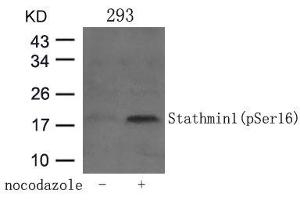 Western blot analysis of extracts from 293 cells untreated or treated with Nocodazol using Stathmin 1(Phospho-Ser16) Antibody. (Stathmin 1 Antikörper  (pSer16))