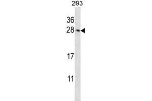Western Blotting (WB) image for anti-Homeobox B4 (HOXB4) antibody (ABIN2998005) (HOXB4 Antikörper)