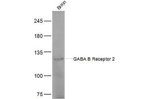 Mouse brain lysates probed with GABA B Receptor 2 Polyclonal Antibody, Unconjugated  at 1:500 dilution and 4˚C overnight incubation. (GABBR2 Antikörper  (AA 501-650))