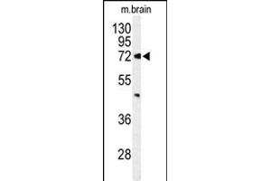 Western blot analysis of ABCD2 Antibody (Center) (ABIN653579 and ABIN2842954) in mouse brain tissue lysates (35 μg/lane).