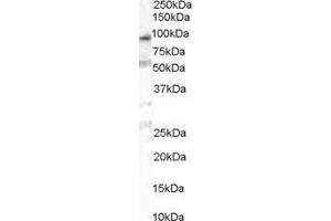 ABIN2564304 (1µg/ml) staining of human duodenum lysate (35µg protein in RIPA buffer). (OSBPL10 Antikörper  (Internal Region))