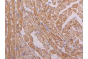 DAB staining on IHC-P; Samples: Mouse Heart Tissue (Hexokinase 1 Antikörper  (AA 676-800))