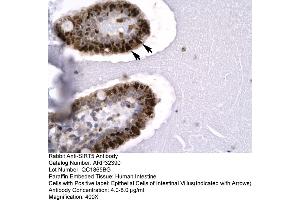 Human Intestine (SIRT5 Antikörper  (C-Term))
