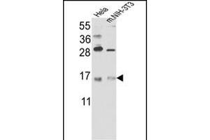Western blot analysis of RBM3 Antibody (C-term) (Cat. (RBM3 Antikörper  (C-Term))