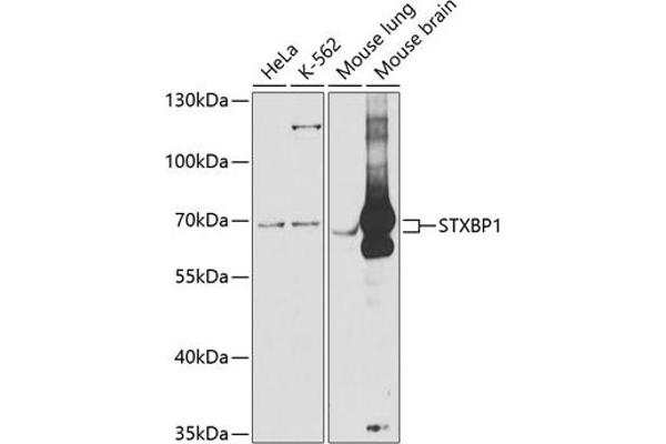 STXBP1 抗体  (AA 295-594)