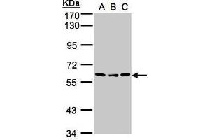 WB Image Sample (30μg whole cell lysate) A:H1299 B:Hep G2 , C:MOLT4 , 7. (Angiopoietin 4 Antikörper  (N-Term))