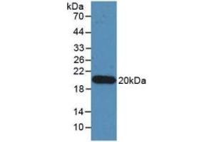 WB of Protein Standard: different control antibodies against Highly purified E. (IL-17 CLIA Kit)