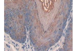DAB staining on IHC-P; Samples: Mouse Esophagus Tissue