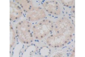 Used in DAB staining on fromalin fixed paraffin- embedded kidney tissue (Fibrillarin Antikörper  (AA 37-275))