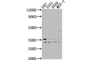 Western Blot Positive WB detected in: U87 whole cell lysate, U251 whole cell lysate, A549 whole cell lysate, MCF-7 whole cell lysate All lanes: ATP6V1D antibody at 1:2000 Secondary Goat polyclonal to rabbit IgG at 1/50000 dilution Predicted band size: 29 kDa Observed band size: 29 kDa (ATP6V1D Antikörper  (AA 1-247))