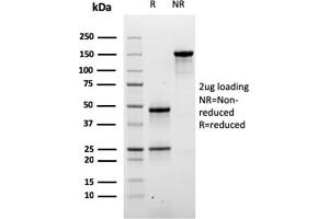 SDS-PAGE Analysis of Purified Desmoglein-3 Mouse Monoclonal Antibody (DSG3/2840). (Desmoglein 3 Antikörper  (AA 379-491))