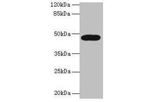 Western blot All lanes: LIPA antibody at 10 μg/mL + A431 whole cell lysate Secondary Goat polyclonal to rabbit IgG at 1/10000 dilution Predicted band size: 46, 40 kDa Observed band size: 46 kDa (Lipase A Antikörper  (AA 22-399))