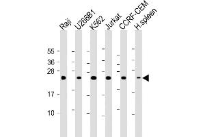 All lanes : Anti- CTLA4 Antibody (N-term) at 1:2000 dilution Lane 1: Raji whole cell lysate Lane 2: U266B1 whole cell lysate Lane 3: K562 whole cell lysate Lane 4: Jurkat whole cell lysate Lane 5: CCRF-CEM whole cell lysate Lane 6: Human spleen lysate Lysates/proteins at 20 μg per lane. (CTLA4 Antikörper  (AA 50-78))