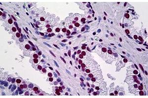 Human Prostate: Formalin-Fixed, Paraffin-Embedded (FFPE) (KAP1 Antikörper  (AA 379-524))