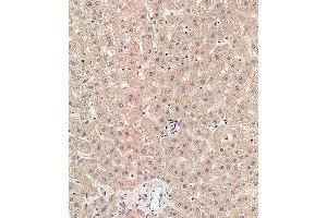 Immunohistochemical analysis of paraffin-embedded human liver tissue using (ABIN657731 and ABIN2846716) performed on the Leica® BOND RXm. (RAB1B Antikörper  (C-Term))
