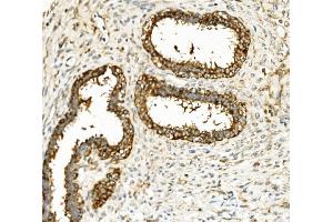 IHC analysis of Hexokinase 1/HK1 using anti-Hexokinase 1/HK1 antibody (ABIN7600258). (Hexokinase 1 Antikörper  (AA 17-323))