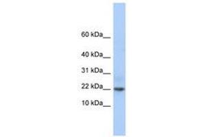 C9orf25 anticorps  (C-Term)
