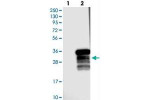 Western blot analysis of Lane 1: Negative control (vector only transfected HEK293T lysate), Lane 2: Over-expression Lysate (Co-expressed with a C-terminal myc-DDK tag (~3. (RRP36 Antikörper)
