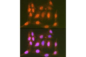 Immunofluorescence analysis of C6 cells using LTH Rabbit mAb (ABIN7268244) at dilution of 1:100 (40x lens). (LTA4H Antikörper)