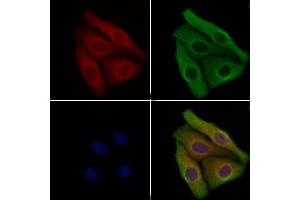 anti-NLR Family, Apoptosis Inhibitory Protein (NAIP) (Internal Region) antibody
