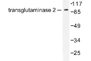 Image no. 1 for anti-Transglutaminase 2 (C Polypeptide, Protein-Glutamine-gamma-Glutamyltransferase) (TGM2) antibody (ABIN271855) (Transglutaminase 2 Antikörper)