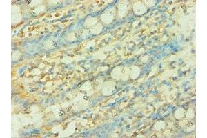 Immunohistochemistry of paraffin-embedded human colon tissue using ABIN7149303 at dilution of 1:100 (CISH Antikörper  (AA 1-257))