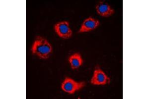 Immunofluorescent analysis of Caspase 9 staining in NIH3T3 cells. (Caspase 9 Antikörper  (Center))