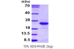 SDS-PAGE (SDS) image for Fibroblast Growth Factor 12 (FGF12) (AA 1-181) protein (His tag) (ABIN666721) (FGF12 Protein (AA 1-181) (His tag))