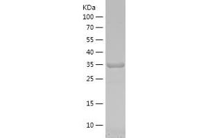 Western Blotting (WB) image for N-Acetylgalactosaminidase, alpha (NAGA) (AA 210-321) protein (His-IF2DI Tag) (ABIN7124083) (NAGA Protein (AA 210-321) (His-IF2DI Tag))