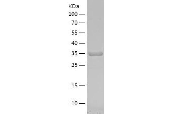 NAGA Protein (AA 210-321) (His-IF2DI Tag)