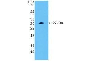 Detection of Recombinant SNAP23, Human using Polyclonal Antibody to Synaptosomal Associated Protein 23 kDa (SNAP23) (SNAP23 Antikörper  (AA 1-211))