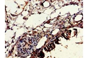 Immunohistochemistry (IHC) image for anti-Vacuolar Protein Sorting-Associated Protein 16 Homolog (VPS16) (AA 7-89) antibody (ABIN7175666)