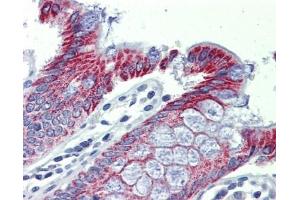 ACAA1 antibody was used for immunohistochemistry at a concentration of 4-8 ug/ml. (ACAA1 Antikörper)