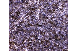 IHC analysis of IL7 using anti-IL7 antibody (ABIN3044526). (IL-7 Antikörper  (AA 26-154))