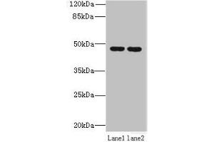 Western blot All lanes: ZDHHC6 antibody at 0. (ZDHHC6 Antikörper  (AA 227-409))