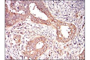 Immunohistochemistry (IHC) image for anti-Eukaryotic Translation Initiation Factor 2A, 65kDa (EIF2A) (AA 448-576) antibody (ABIN1724933)